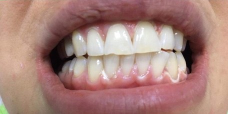 The patient complained of a cosmetic defect