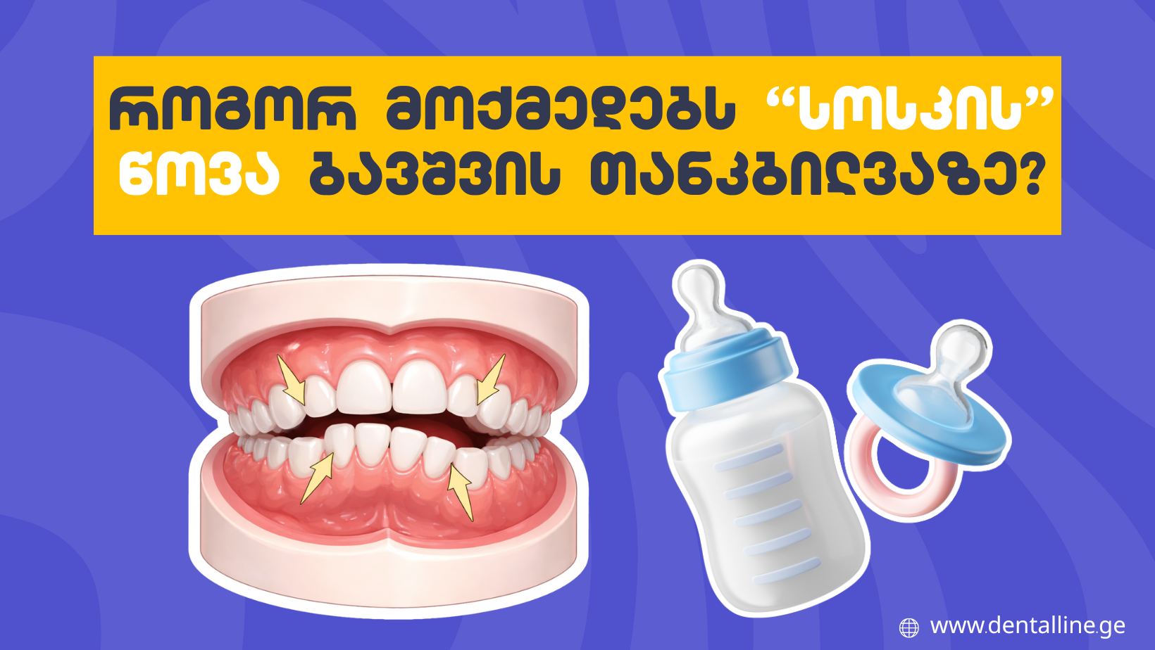 როგორ მოქმედებს “სოსკის” წოვა ბავშვის თანკბილვაზე?