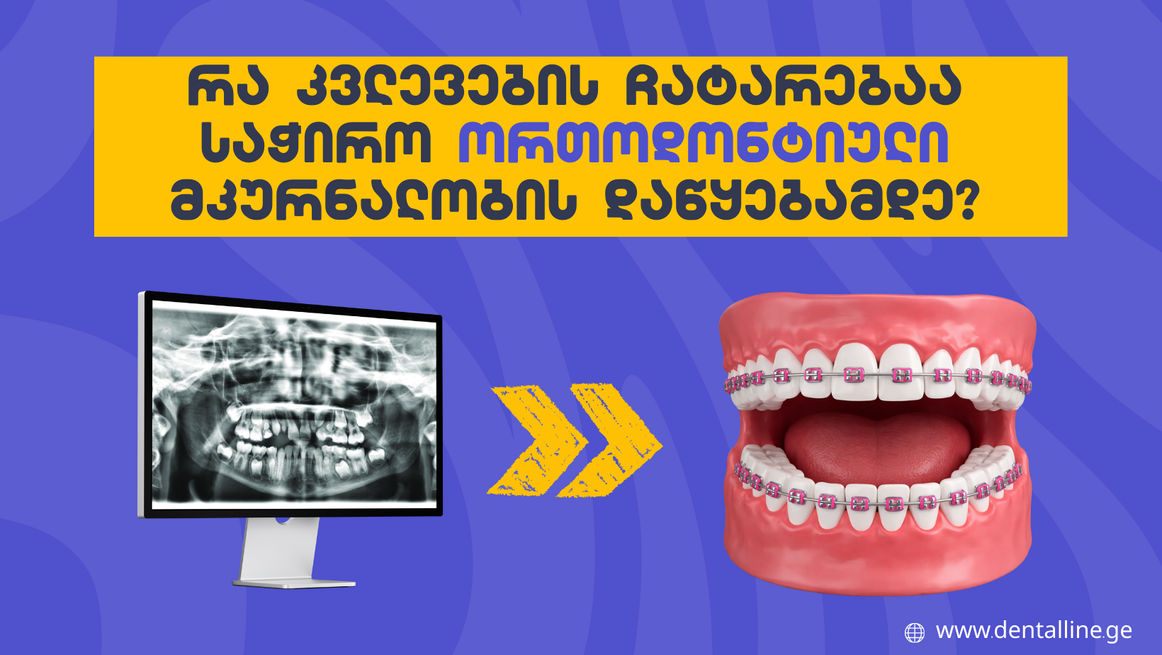 რა კვლევების ჩატარებაა საჭირო ორთოდონტიული მკურნალობის დაწყებამდე?